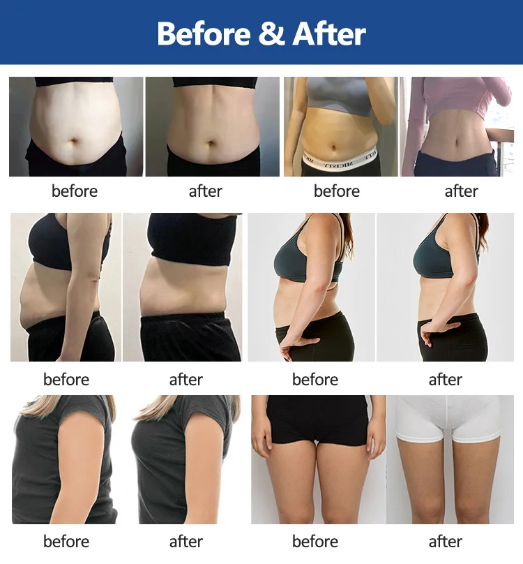 8 Pads Cryo Lipolysis Cryotherapy Fat Freezing Body Sculpting Machine 16 Discover the professional 8 Pads Cryo Lipolysis Cryotherapy Machine for non-invasive fat freezing, body sculpting, slimming, and advanced cryotherapy contouring treatments for salons and med spas. 8 Pads Cryo Lipolysis Cryotherapy Fat Freezing Body Sculpting Machine
