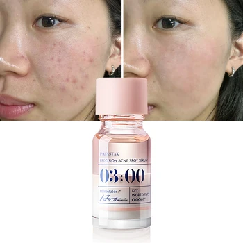 Dry oily skin acne treatment powder water essence factory wholesale