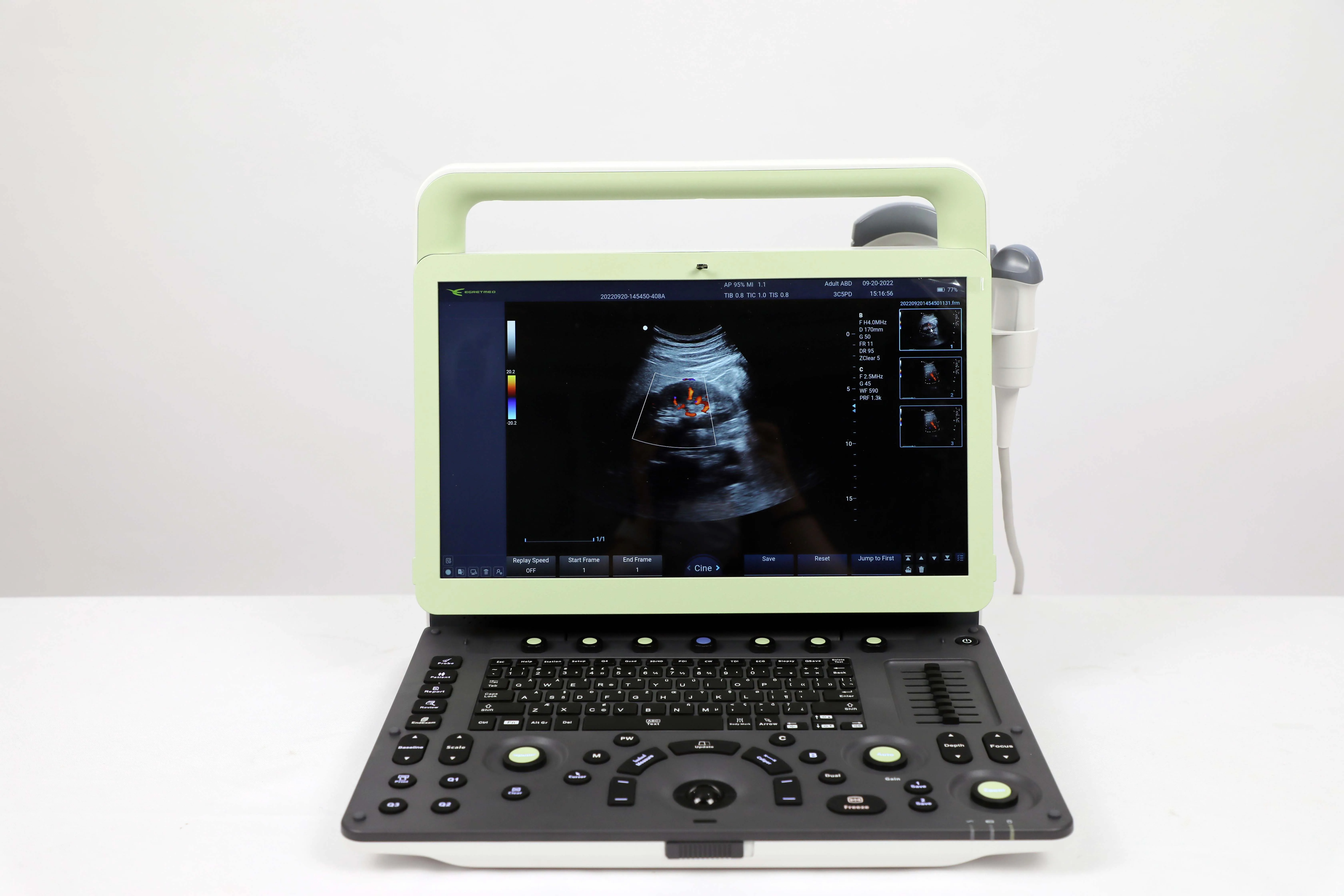 Medsinglong Color Doppler Ultrasound Machine Ecocardiografo Medical ...