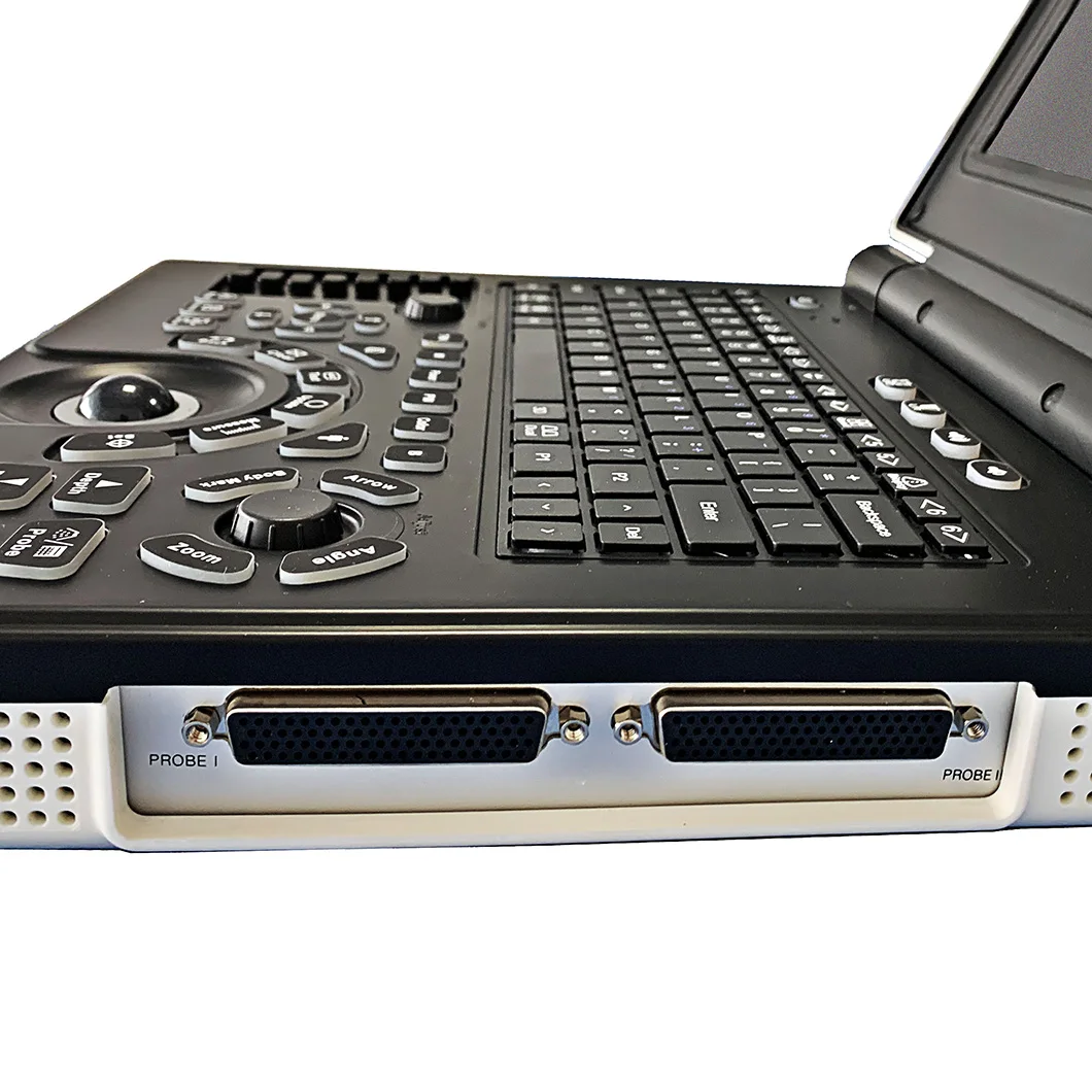 Medical Diagnostic Equipment Cheap Portable Laptop Human Color Doppler Ultrasound Scanner