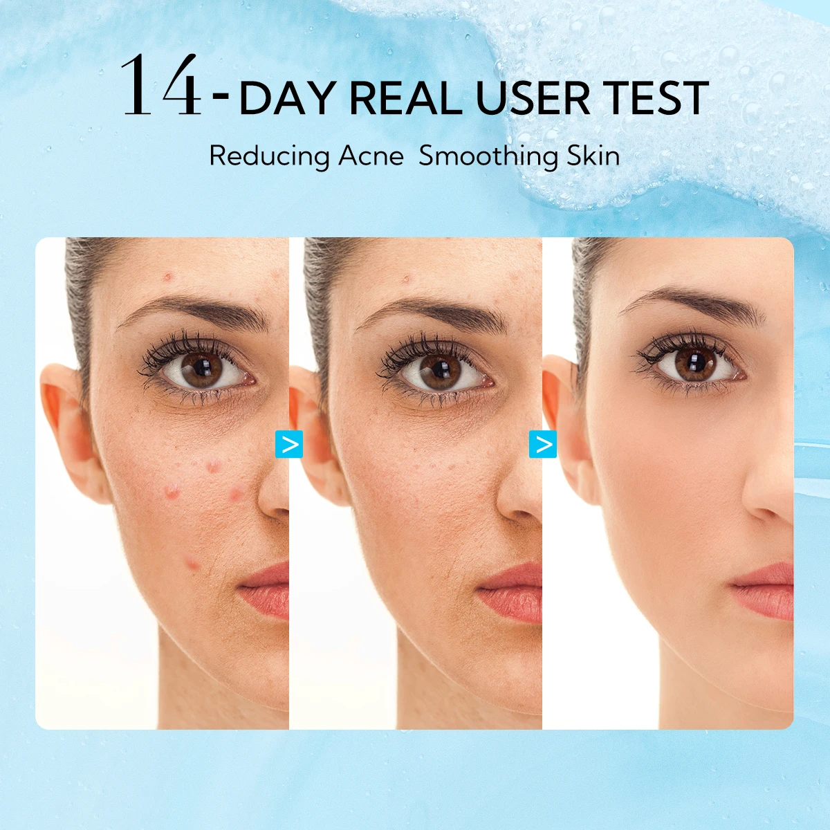 Lanbena Private Label Cleanser Face Wash for Women Whitening Acid Facial Cleanser manufacture