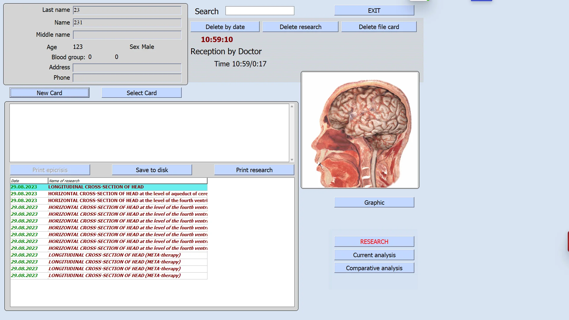 DIZI TC-3000 9D CELL NLS Diagnostic Sub Health Body Analyzer 18D System Quantum Bioresonance Magnetic Non Linear Device