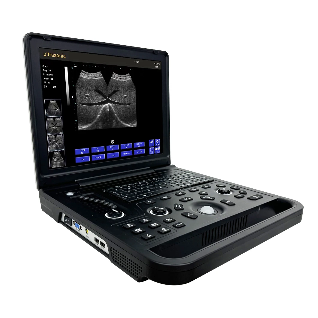 CE Approved Hospital Diagnostic Ultrasound Scanner Equipment Medical Portable Ultrasound Machine
