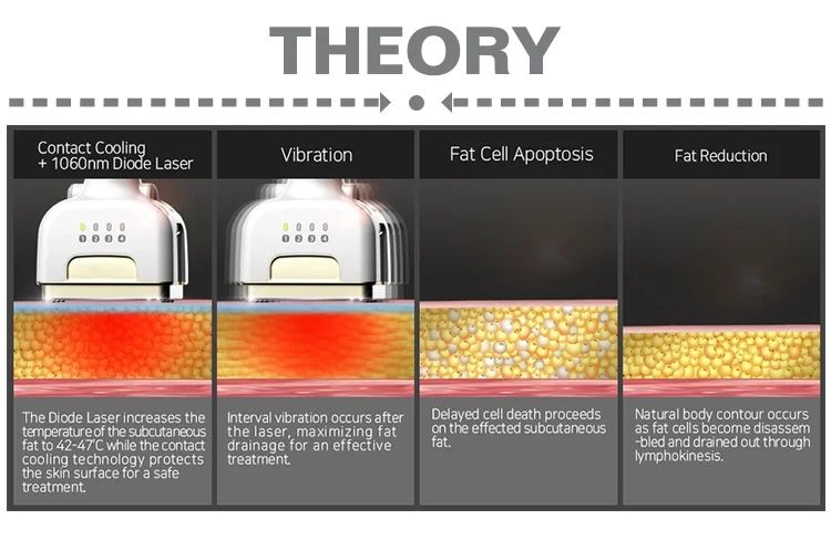 Laser Slimming Machine 1060nm Fat Lipolysis Fat Loss Equipment Diode Laser Body Contouring 1060