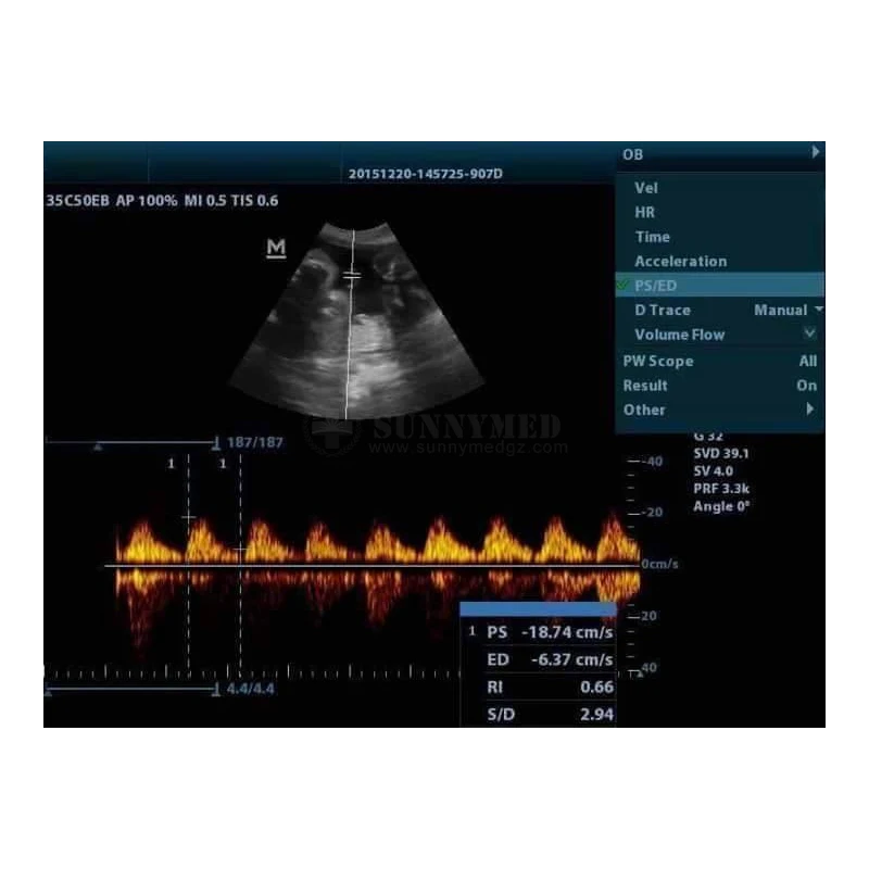 High Quality Medical Ultrasound Machine Mindray DP-20 Potable Digital Ultrasound Device for Abdomen, OB, GYN, Cardiology