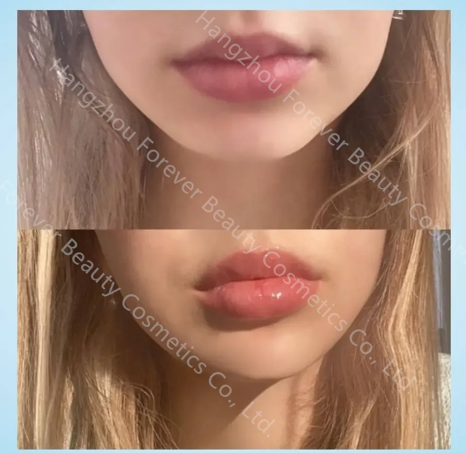Strong Effect Version Lip Booster High Quality Custom Logo Hyaluronic