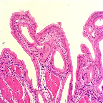 Set Di 25 Diapositive Per Microscopio - Invertebrati E Insetti Per