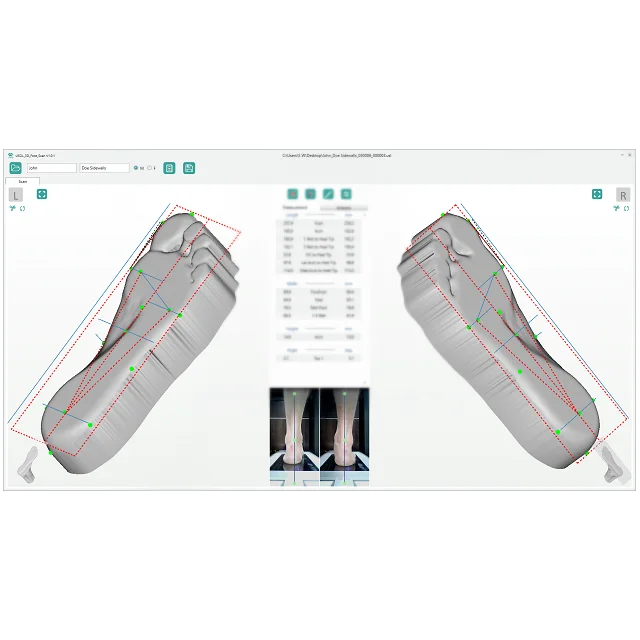 Speed foot. 3d сканер scanpod3d Usol. 3д сканирование ноги. 3d сканирование стопы для обуви. Ортопедический сканер стопы.