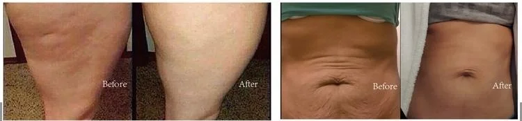 100% натуральный жиросжигающий продукт Фирменная торговая марка горячий крем для похудения целлюлитный