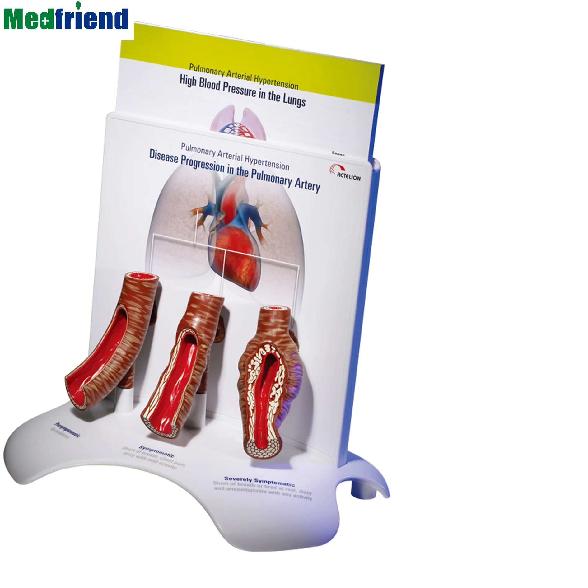 工厂价格上涨肺动脉高血压模型 - buy advanced pulmonary arterial