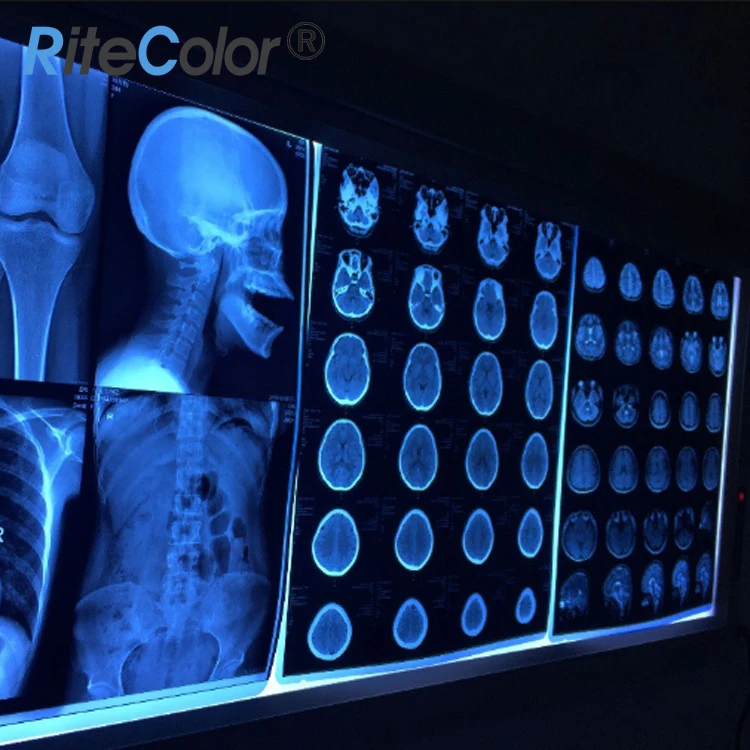 
 210mic лазерная печать струйная цифровая Xray синяя медицинская пленка для принтера Canon Epson  