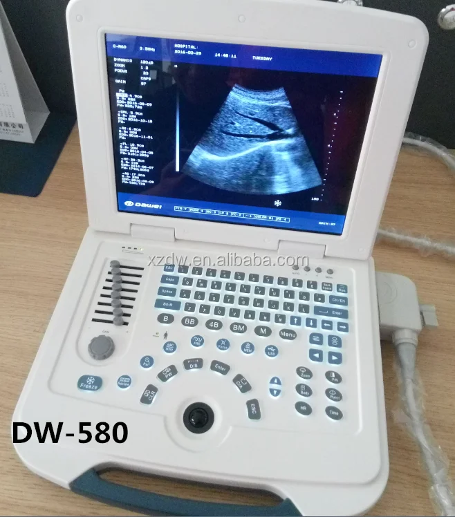 
 Dawei, низкая цена, портативный ультразвуковой сканер для беременных DW580  