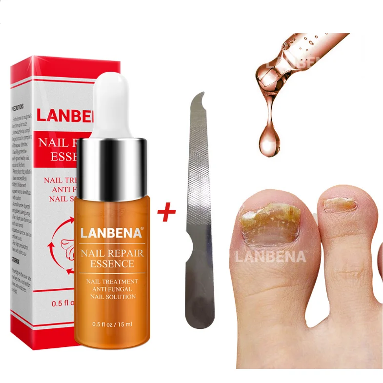 lanbena nail repair