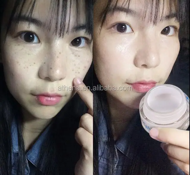 dark spot cream athena