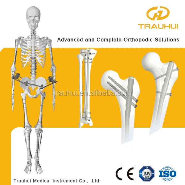 Intrameduller Gecmeli Civi Ortopedik Tibbi Implant Femur Tibia Humerus Kirigi Buy Intrameduller Tirnak Gecmeli Civi Ortopedik Implant Product On Alibaba Com