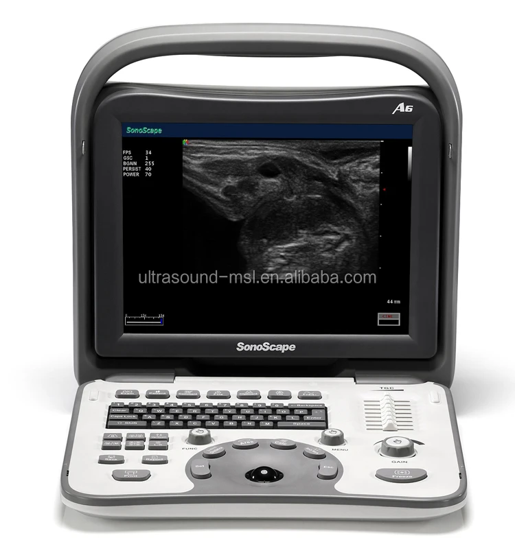 Unlu Marka Sonoscape A5 Tasinabilir Siyah Beyaz Ultrasonik Sistemi Ultrason Makinesi Ucuz Fiyat Buy Sonoscape Ultrason Ucuz Tasinabilir Ultrason Makinesi Ultrason Makinesi Fiyati Product On Alibaba Com