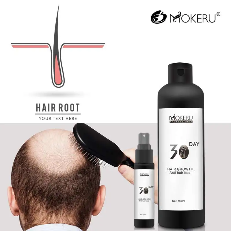 OEM manufacturer mokeru mens natural herbal hair loss treatment growth oil product for anti-hair loss and hair regrowth quickly
