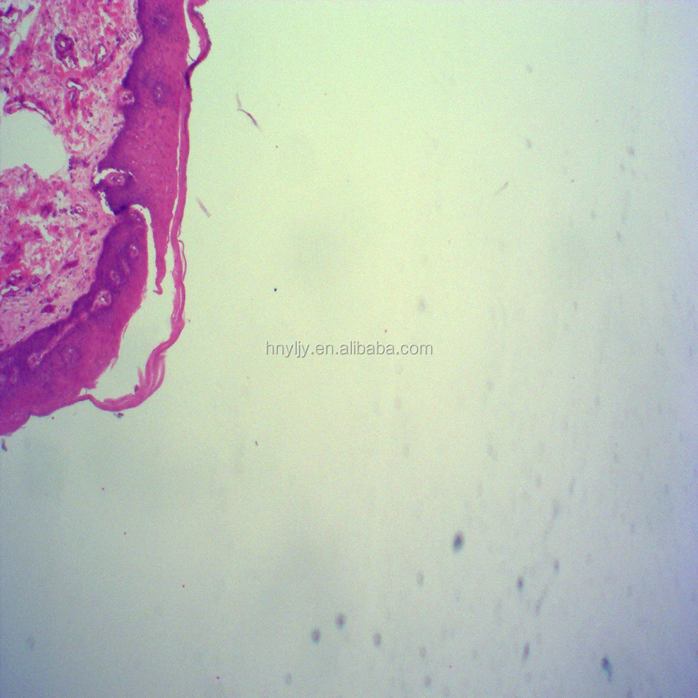 100 pcs eccellente istologia umana ha preparato le diapositive del  microscopio