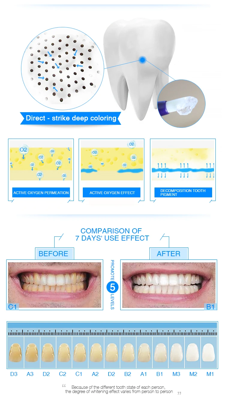 Effective Teeth Whitening Gel Professional Teeth Whitening 12 Hydrogen
