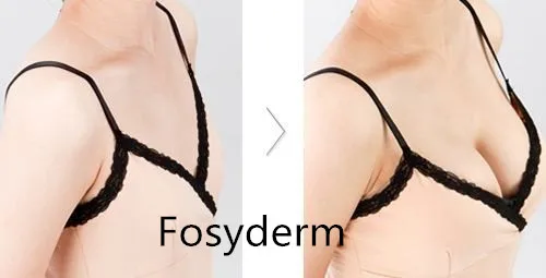 Fosyderm 20 Ml Subskin Breast And Buttocks HA Dermal Filler