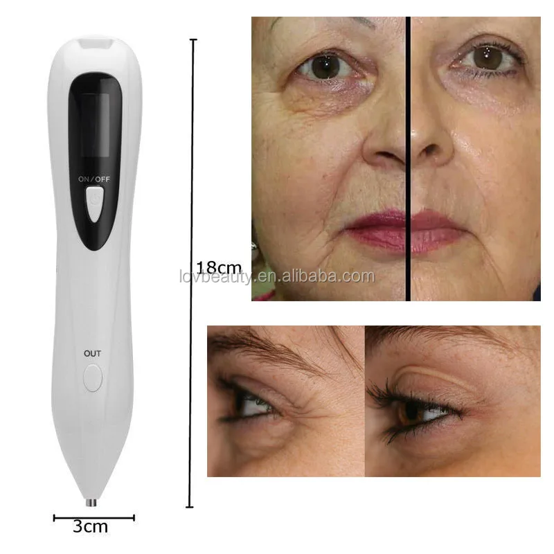 Plasma Pen Eyelid Lifting Spot Remove Firbroblast Pen Buy Plasma Lift Plasma Pen Fibroblast Lift Product On Alibaba Com