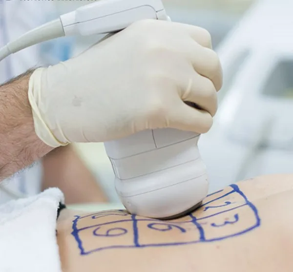 High-effective-lipo-hifu-ultrasound-cellulite-removal (3)