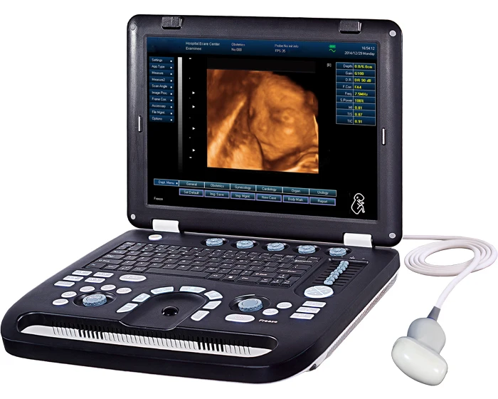 How much does it cost for a 3d 4d ultrasound