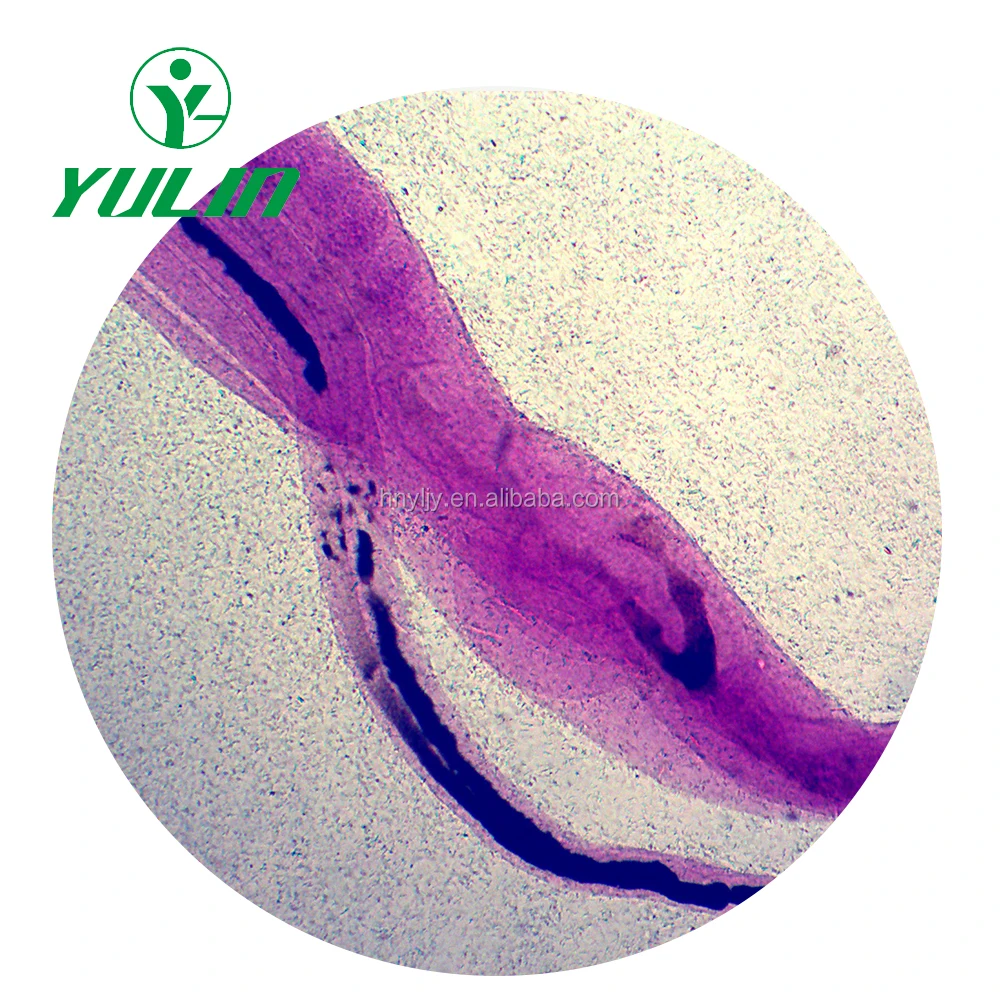 Медицинские паразитологические слайды, аскарис митозные слайды, медицинские паразитологические слайды