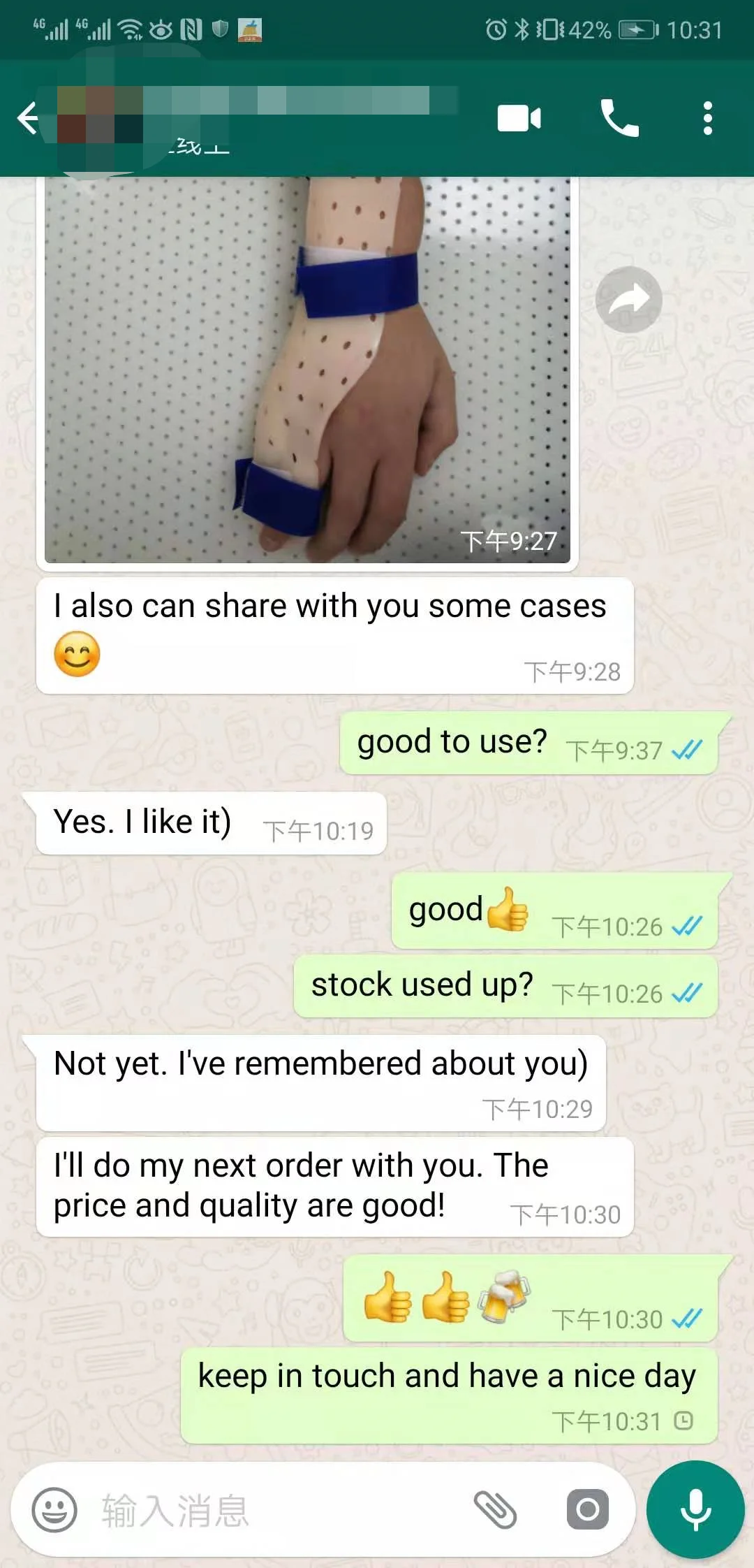 Orthopaedic Thermo Plastic Splinting Material Resting Hand Sugar Tong