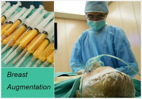 High Quality Stem Cell Fat Transfer Centrifuge for 20cc 50cc Syringes Lipo Suction Treatment Beauty Clinic Use