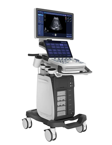 Value and Significance Sonoscape P20 Digital Color Doppler Ultrasound
