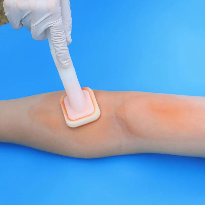 Aplicador de hisopo antiséptico con punta de esponja de espuma de gluconato de clorhexidina CHG preoperatorio quirúrgico médico para la piel