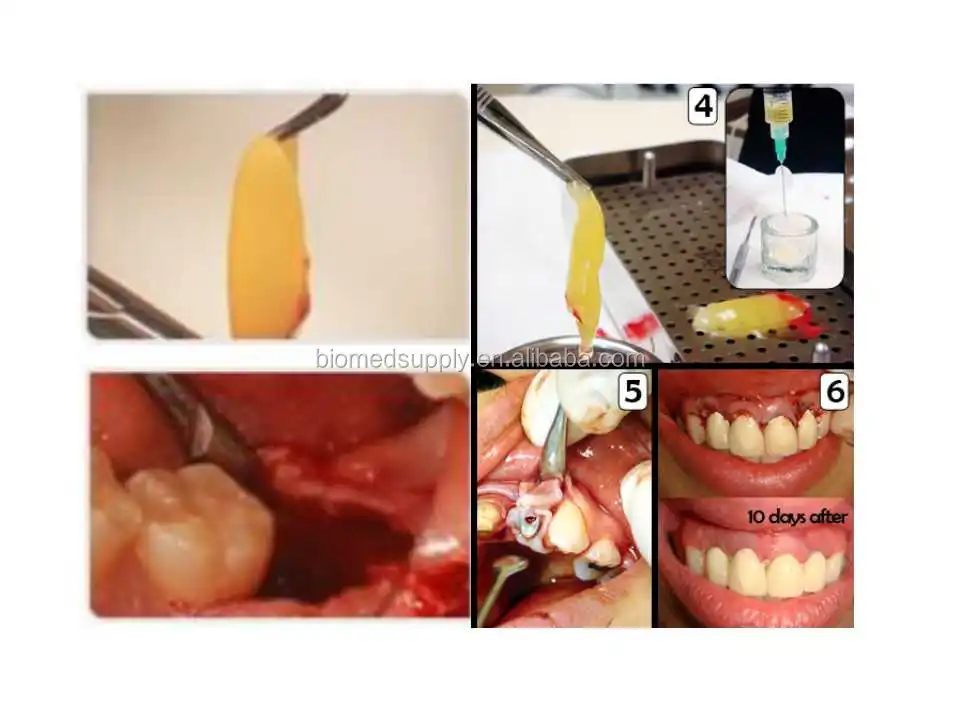 2021 Hospital Equipment PRF Centrifuge with Angle rotor 12 tubes centrifuge for dental use