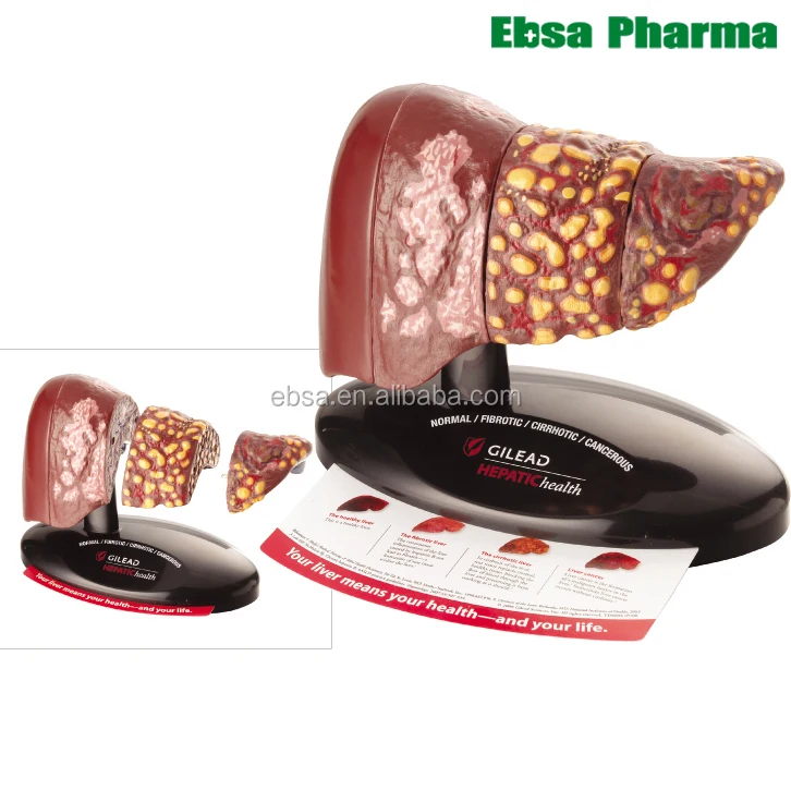 Современные медицинские принадлежности, четырехступенчатая модель печени для обучения человеку
