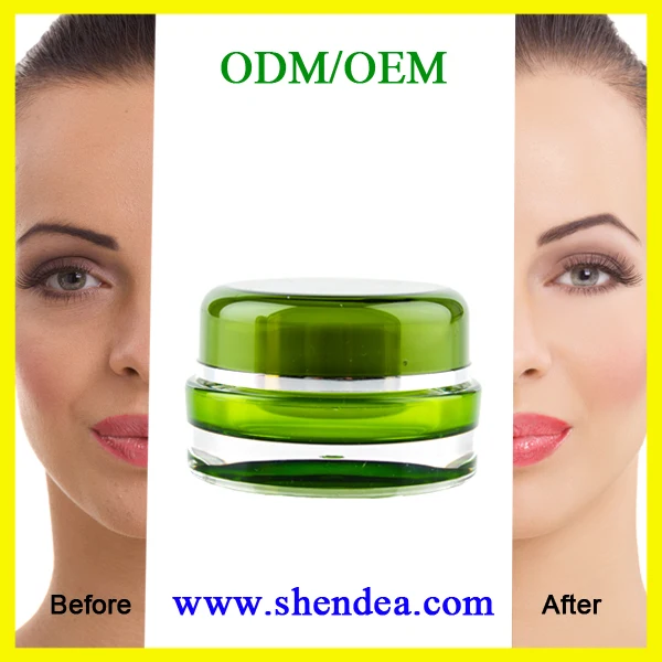 best skin pigmentation removal cream