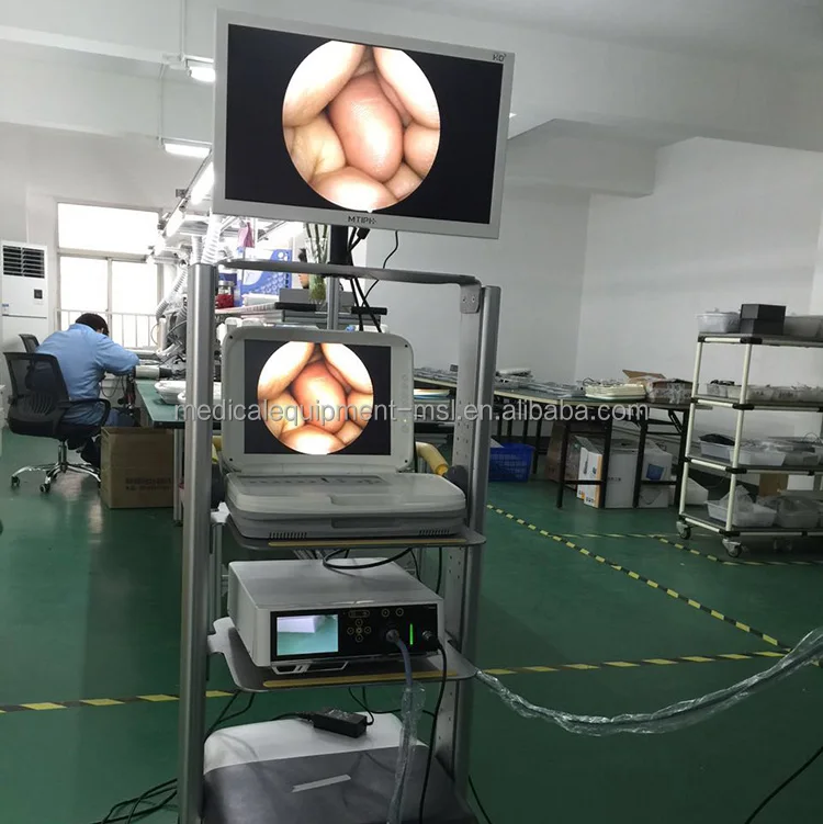 Professional Supplier Vagina Endoscope Camera With Built-in Cold Light Sour...