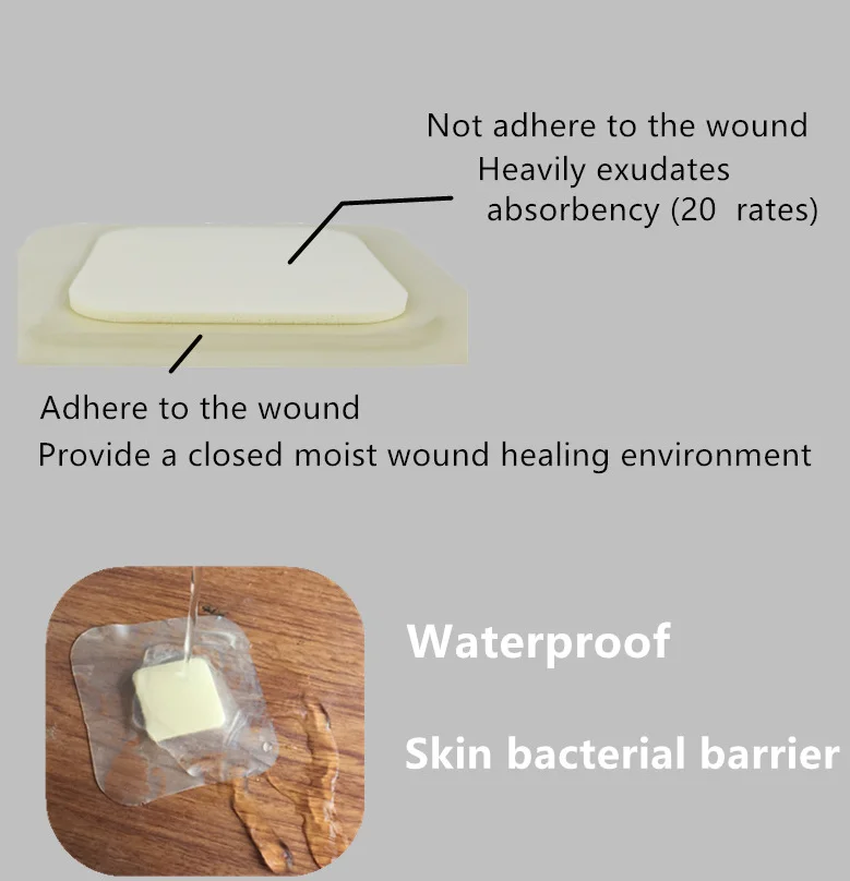 Hydrocolloid Surgical Foam Dressing Pad For Wound Care Of Minor Burns And Traumatic Wounds Buy