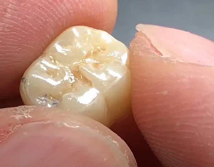 dental composite polishing burs,zirconia polishing tools,dental bur