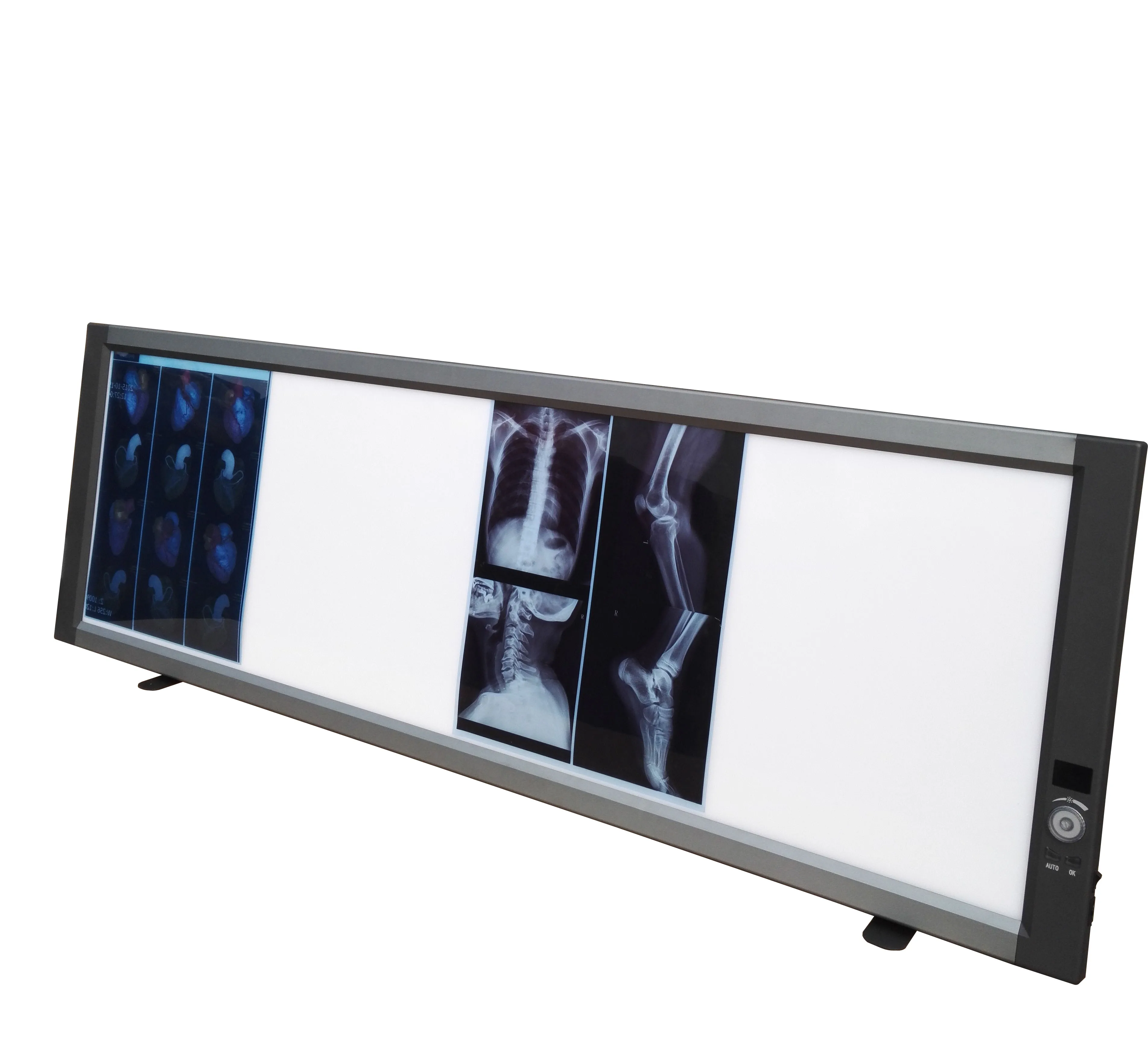 4 Panels LED X Ray Medical Film Viewer