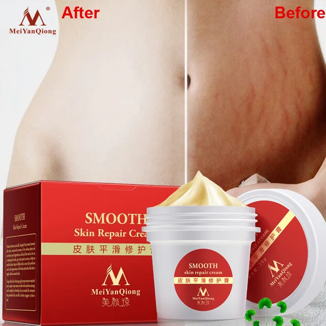 smooth skin repair
