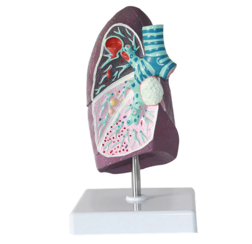 教育病变全尺寸肺解剖模型 - buy plastic lung,lung model
