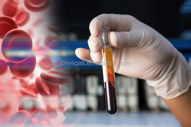 PRP tube PRP kit.png