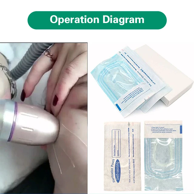 Water Soluble Protein PDO Threads Lifting Needleless Radar V Engraved