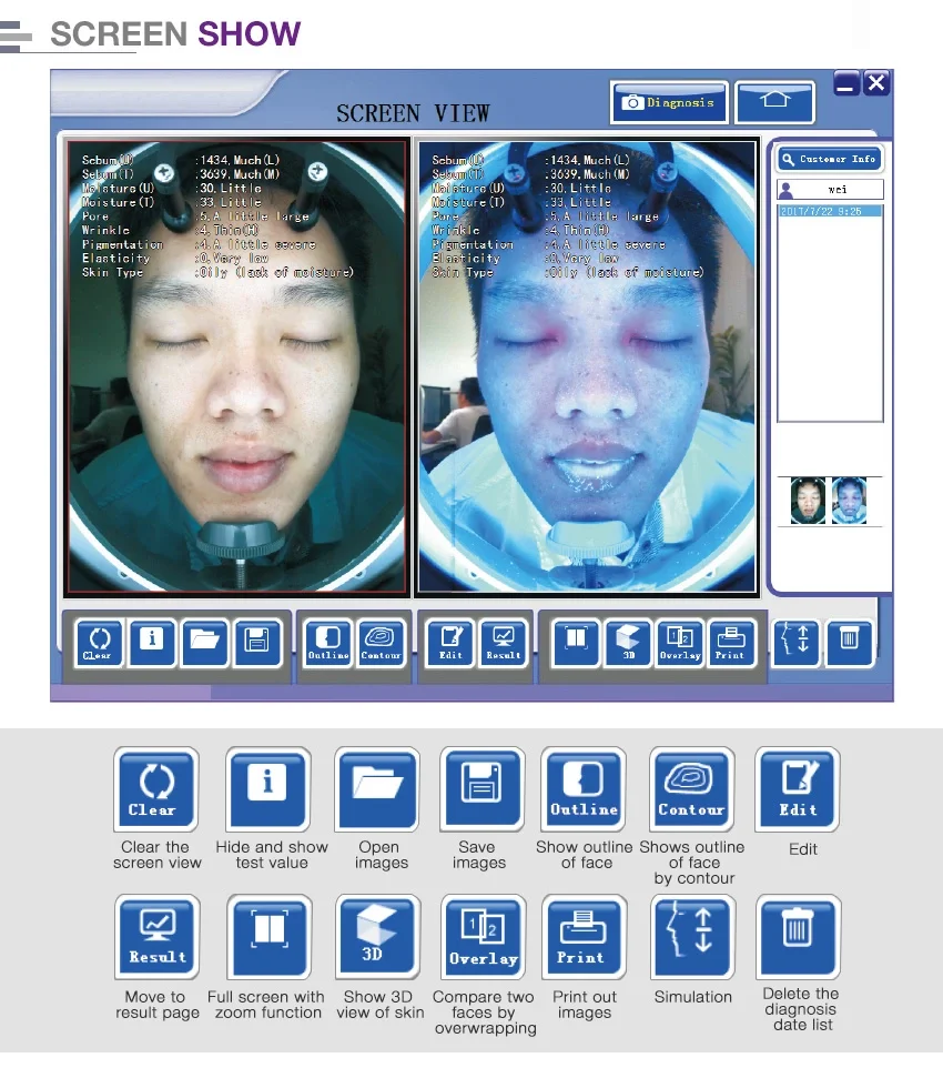 BECO 2025 Portable 3d Skin Analysis Facial Uv Wifi Skin Scan Skin ...