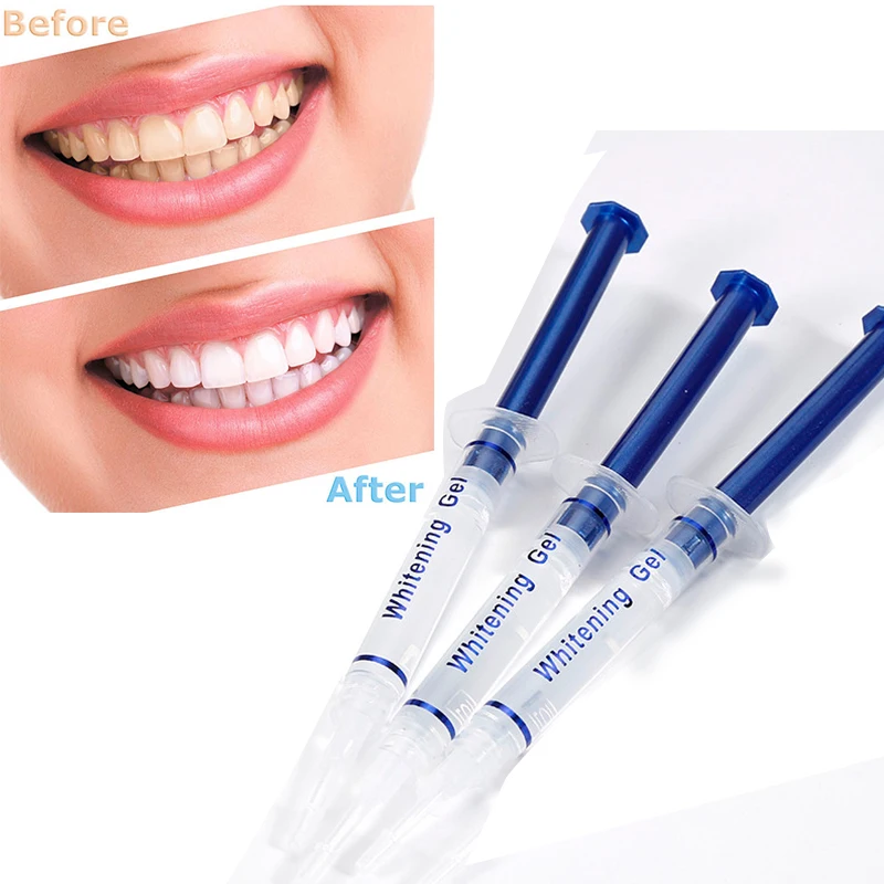 Professional Manufacturer Portable Teeth Whitening Gel Kits Wholesale