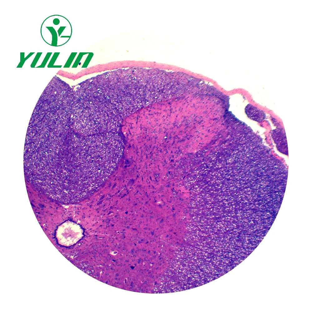 11.5: Spinal Cord - Medicine LibreTexts, image size:1000x1000