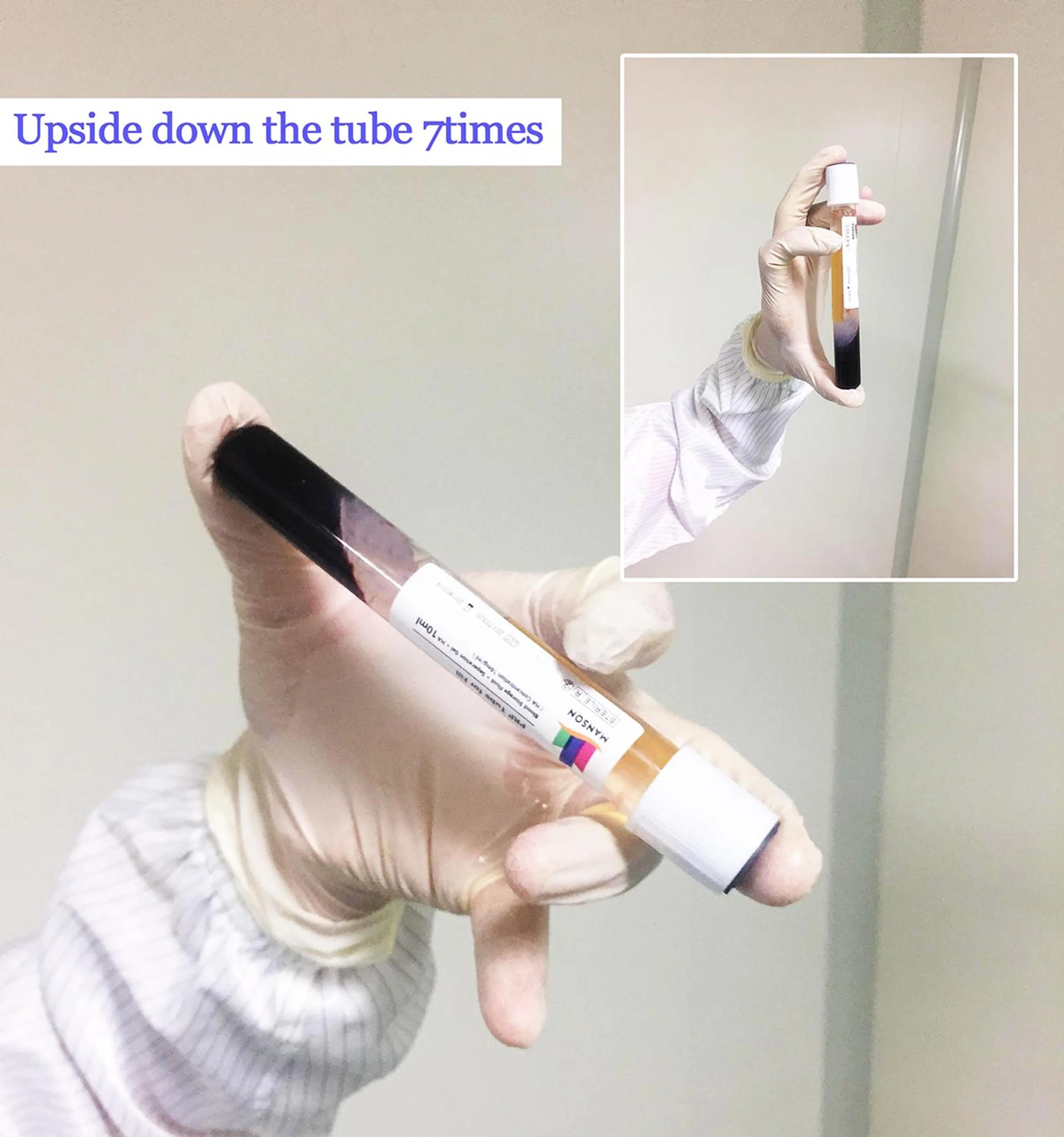 OEM PRP FACTORY Professional Medical Gel плазма 10 мл PRP трубка