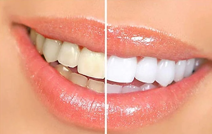 Herbal Extracts Teeth Whitening Toothpaste For Sensitive Gum Problems