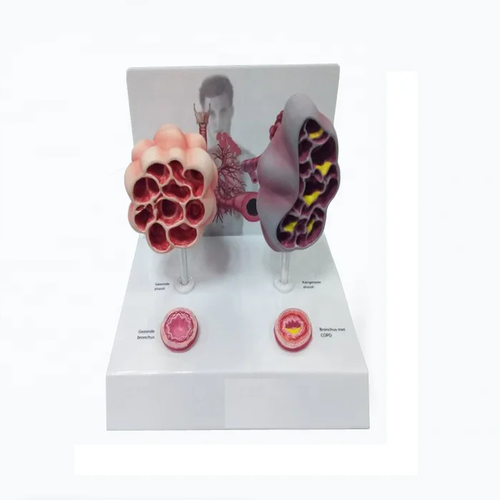 magnified pulmonary alveoli and bronchus model - buy magnified