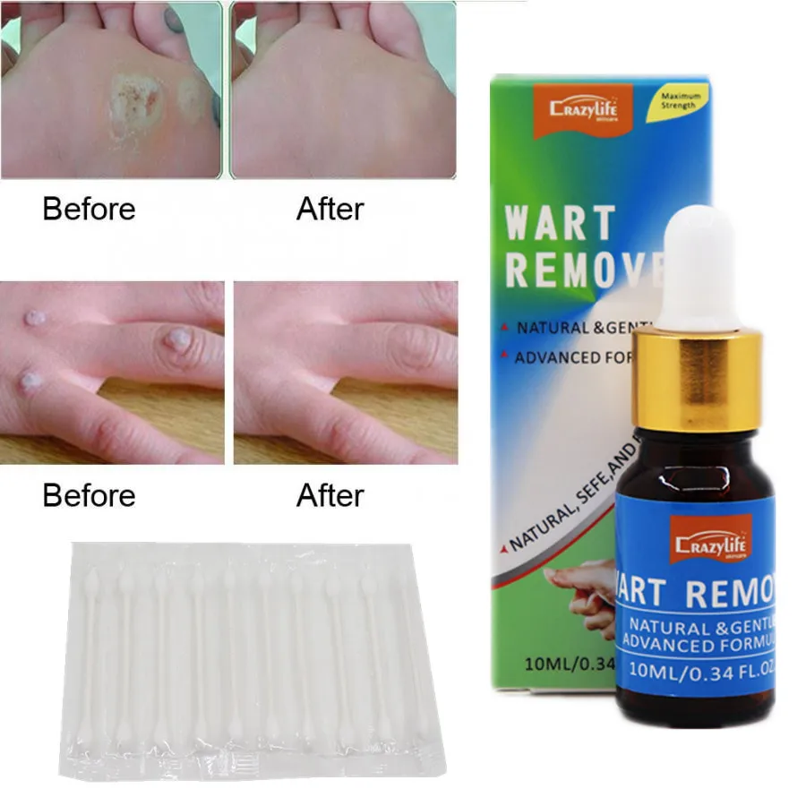 
Средство для удаления родинок, бородавок, мозолей, черных точек, 10 мл 